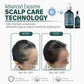 SH-RD EXOSOME Scalp Revival Shampoo (6.76oz/200ml)