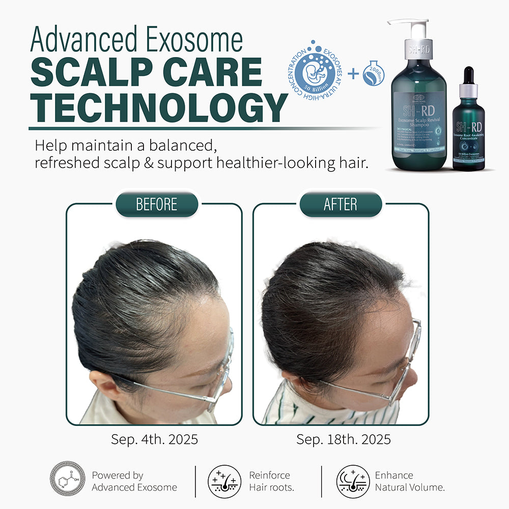 SH-RD EXOSOME Scalp Revival Shampoo (6.76oz/200ml)