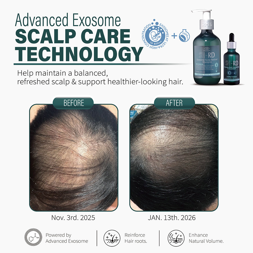 SH-RD EXOSOME Scalp Revival Shampoo (6.76oz/200ml)