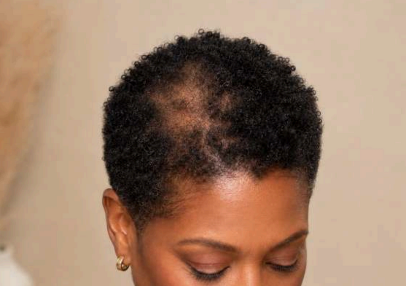 Routine for Visible Crown Thinning