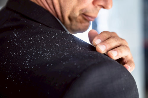 Dry Scalp with Dandruff