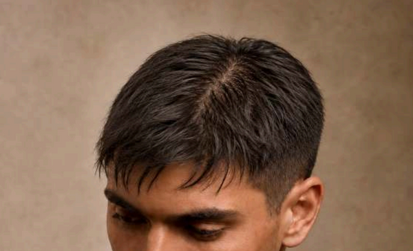 Oily Scalp