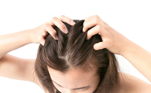 Itchy or Sensitive Scalp